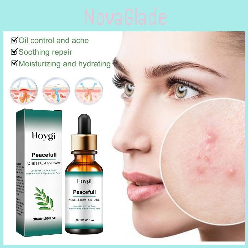 Hoygi Acne Essence With Hydrating Properties For Reducing Blemishes And Pore Refinement