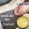 Winter Protection Cream: Moisturizes, Repairs Cracked Hands & Feet, Exfoliates, Heals Dry Skin
