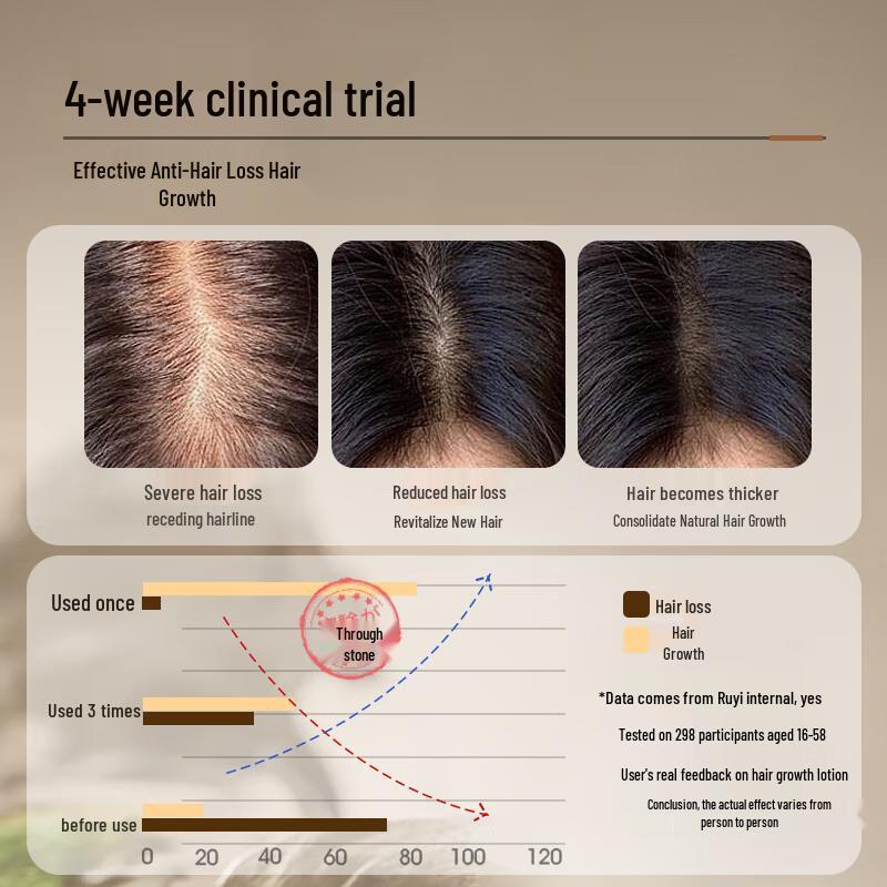 RUYI Hair Growth & Anti-Hair Loss Scalp Essence