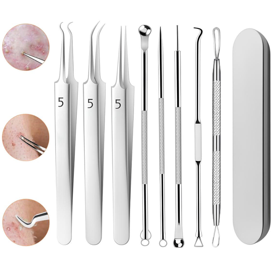 

Blackhead Tweezers Set Precision Tweezers for Removing Powder and Perfect for Acne Stainless Tips for Blackhead Removal and Comedo Extraction -