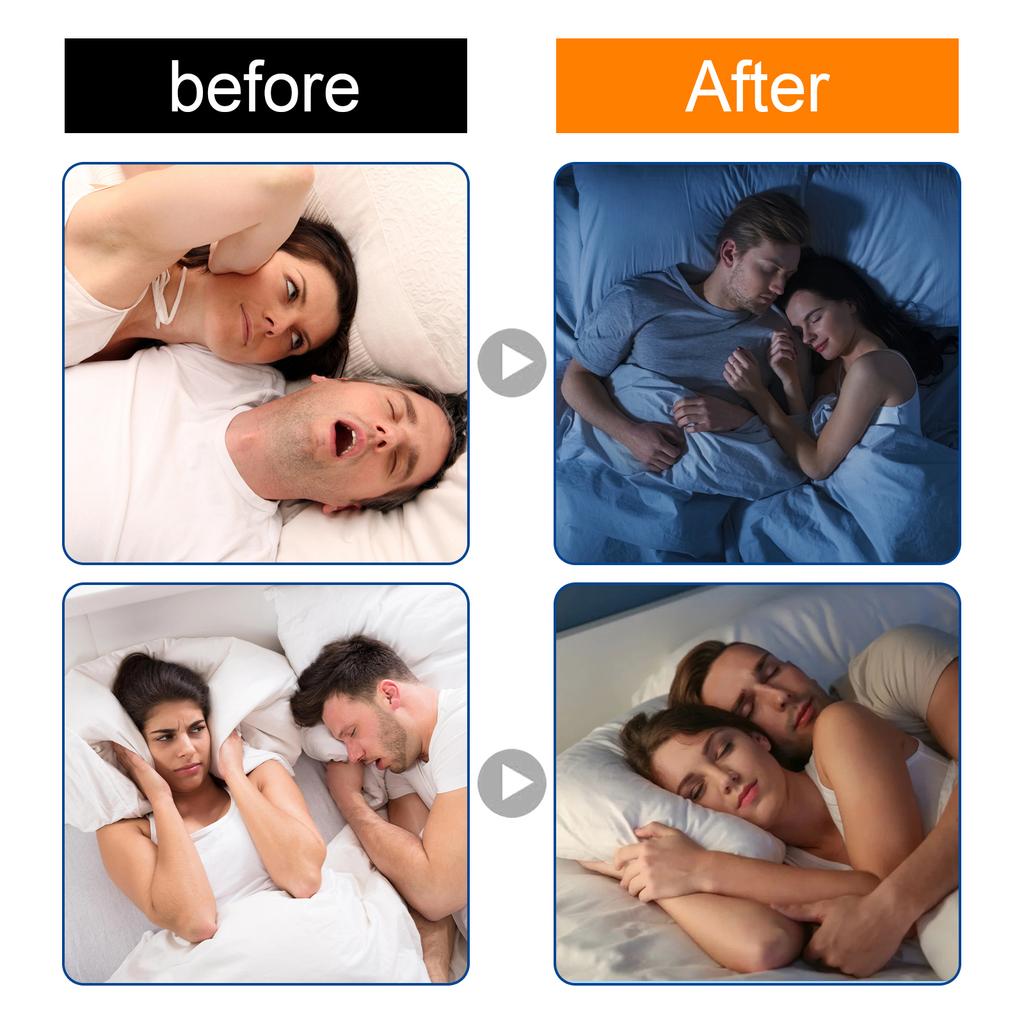 South Moon 60PCS Anti Snoring Strips For Adults Night Mouth Strips Instant Nasal Breathing Aid