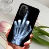 For Redmi K40 5G Case K40 Pro Cute Animals Matte Silicone TPU Soft Phone Cover For Xiaomi Mi 11i Fundas Poco F3 Coque Bumper