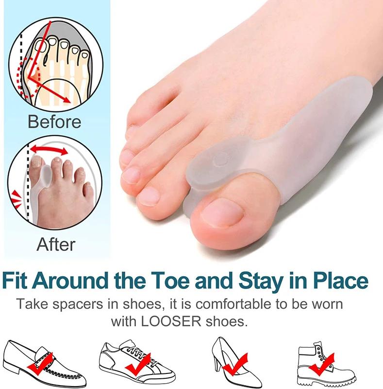 Get Relief from Bunions with 2pcs Soft Big Toe Corrector - Perfect for Night and Home Use, Long-term Comfort