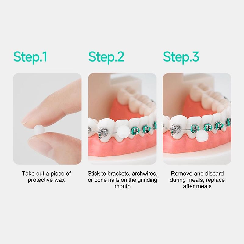 60Pcs Dental Orthodontic Wax Protective Brace Wax Orthodontic Anti-Grinding Food Grade Individually Packaged Superior Hygiene