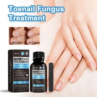 Extra starke Nagelpilz-Behandlung, natürliche Reparatur- und Erneuerungslösung mit 7 Ölen, einfache Anwendung, Lösung für gesunde Nägel, für Zehennägel und Fingernägel