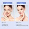 Electric V-Face Lifting Beauty Device Double Chin Remove EMS Face Slimming Red/Blue Light Heat Massage Face Lifting Machine Care