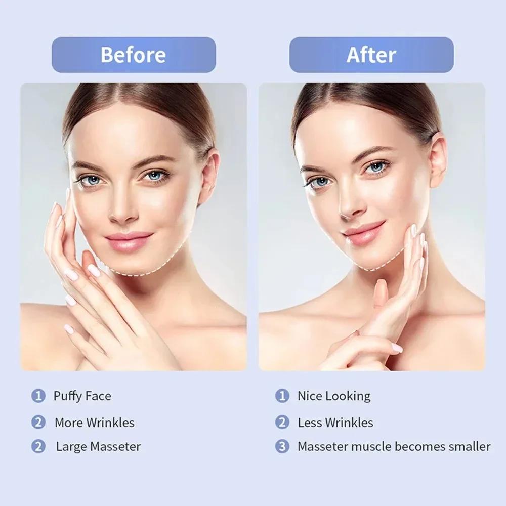 Electric V-Face Lifting Beauty Device Double Chin Remove EMS Face Slimming Red/Blue Light Heat Massage Face Lifting Machine Care