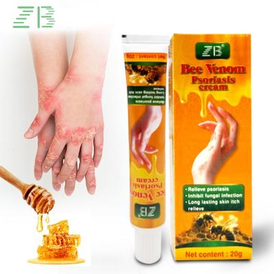 Bee Venom Chinese Skin Care Cream Foot Massage External Multifunction For Itchy