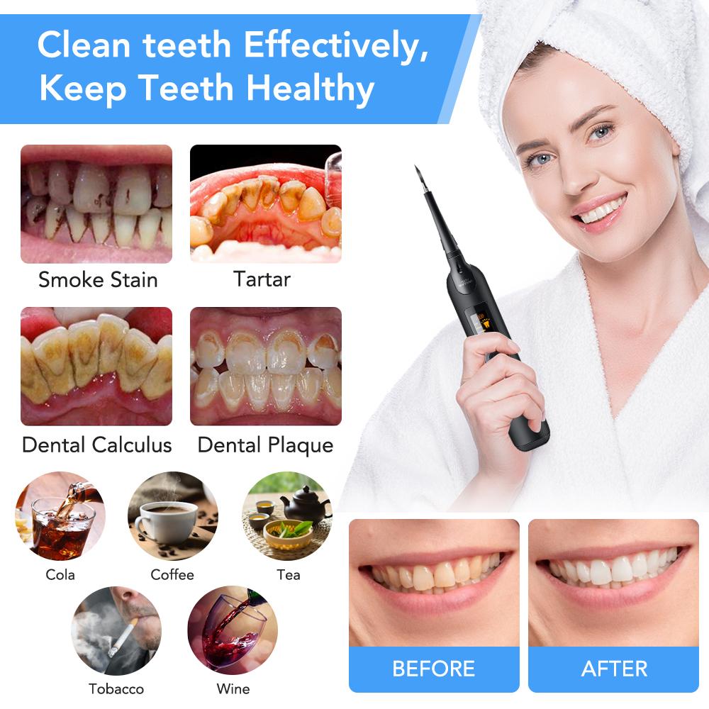 LED Elektrisk Dental Scaler Tannbørstesett Flekker Dental Calculus Remover Tannrenser Tannbleking Oral irrigation Care Tool