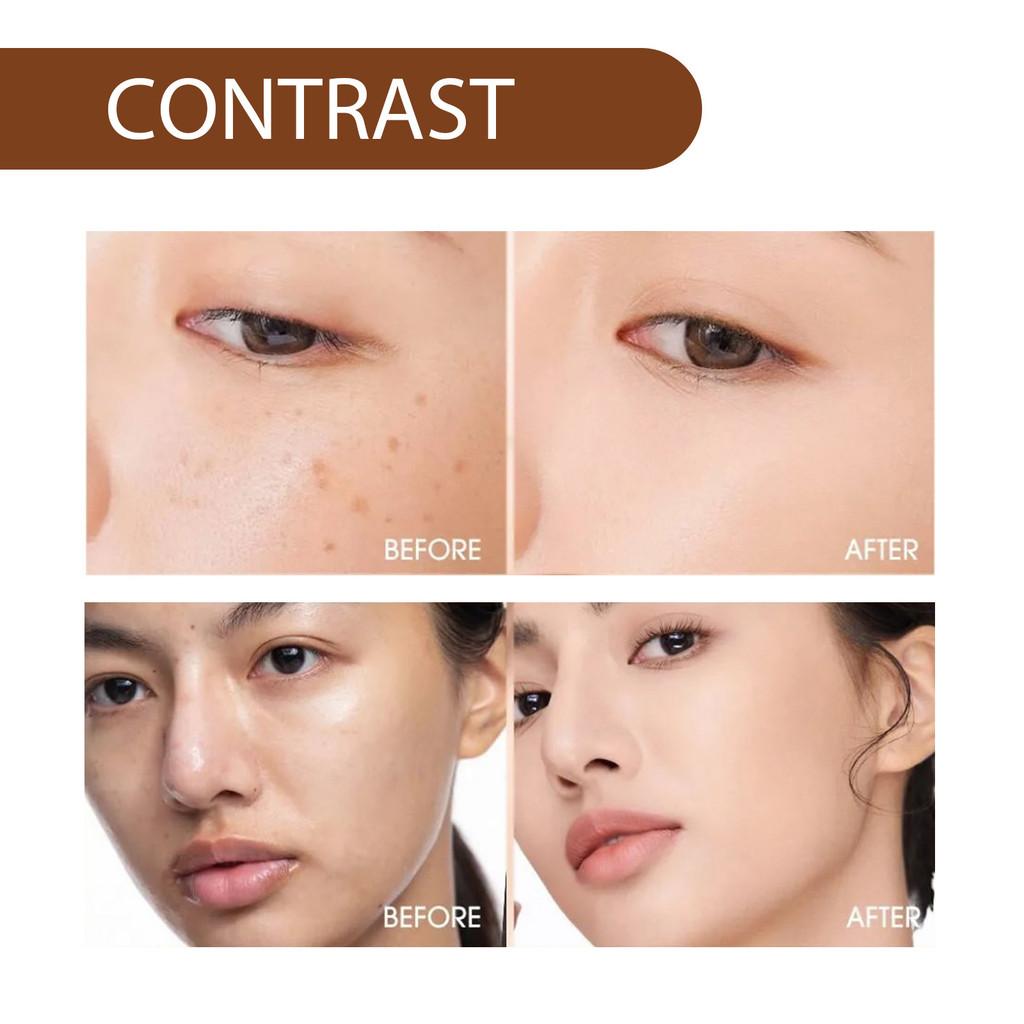 Hoygi Niacinamide Spot Brightening Serum Hydrating And Nourishing Skin Treatment For Dark Spots And Dull Complexion