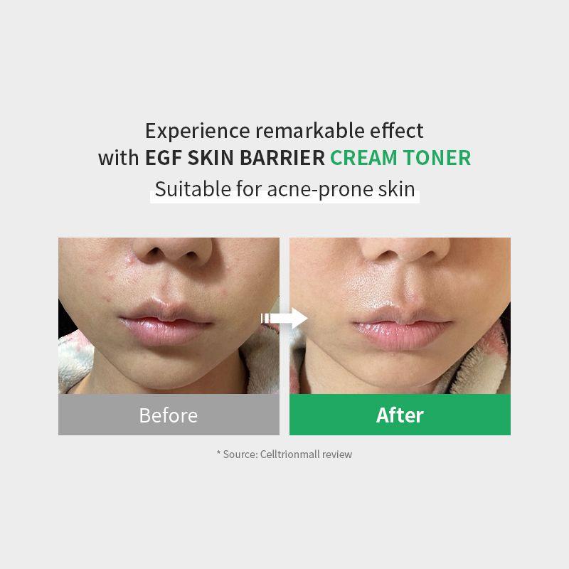 [zipiderm] EGF Skin Barrier Cream Toner 150ml