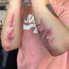 Horror Realistic Fake Bloody Wound Stitch Scar Scab Waterproof Temporary Tattoo Sticker Halloween Masquerade Prank Makeup Props