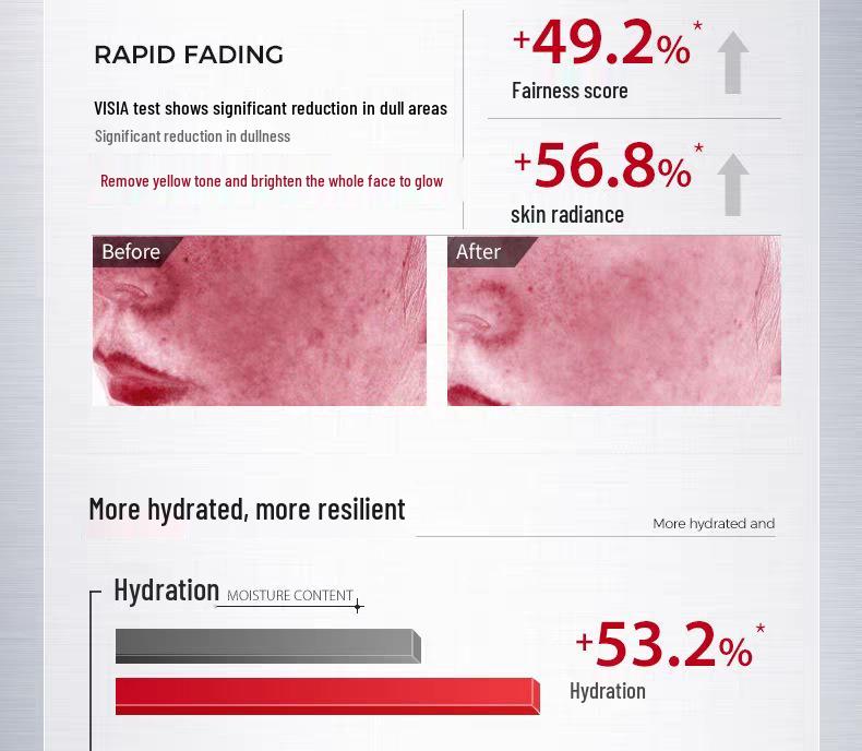 Brightening Spot Cream: Fades Pigmentation, Improves Skin Tone and Texture, Reduces Melasma and Yellowing