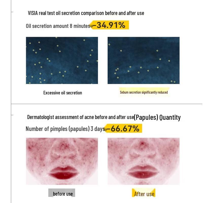 

Yumeijing Teenager Acne & Oil Control Toner