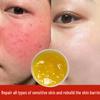 High-Efficiency Repair Cream for Redness, Rosacea, Sensitive Skin, and Thickening Stratum Corneum