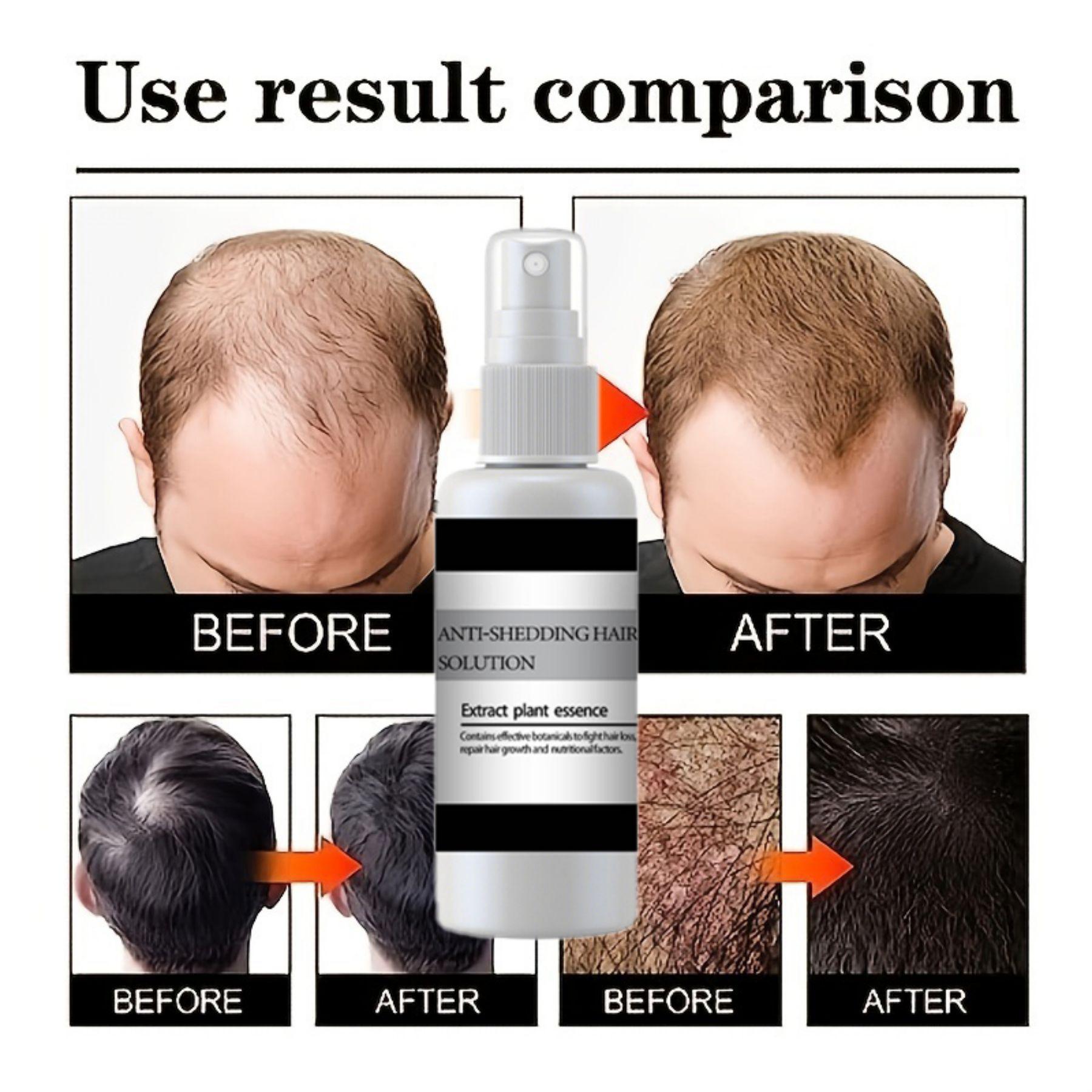 

Спрей-сыворотка для роста волос от выпадения волос Основные продукты Быстрое лечение Предотвращает истончение волос Сухое вьющееся восстанавливающее масло