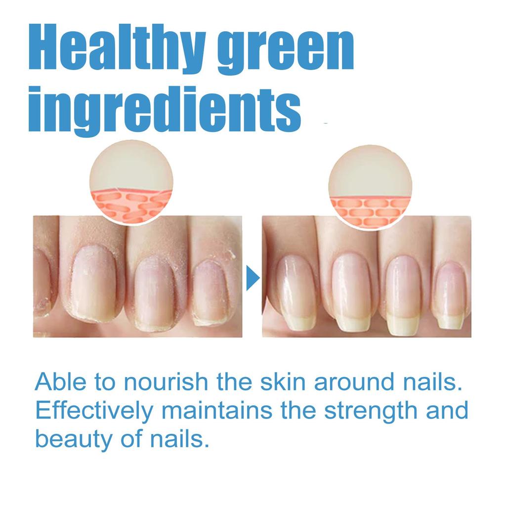 Multi-purpose Nail Care Stickers, Care For Damaged Nails, Effectively Improve The Appearance Of Damaged Fingernails And Toenails