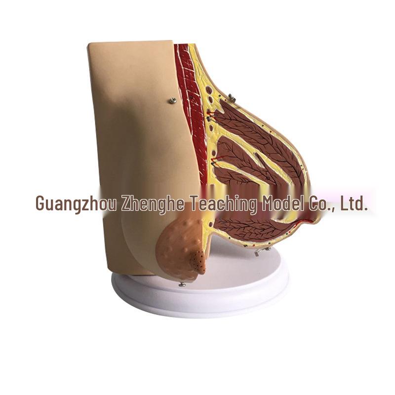 Breast Anatomy Model for Lactating Women: Gynecology Teaching Aid 18.5cm Height, 13cm Width, 13cm Depth