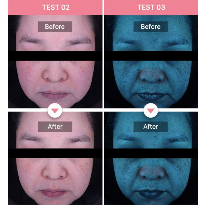 Medicube Toner Lacté Niacinamide Rose 250ml (3 Options)