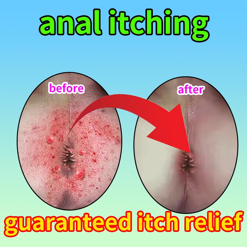 Anti-Itching Anal Ointment