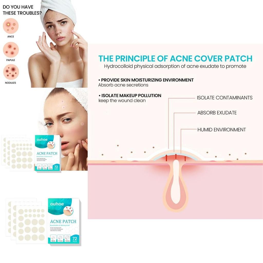 Ouhoe Acne Patches Gentle And Non-irritating Hydrocolloid Stickers For Flawless Skin 72pcs