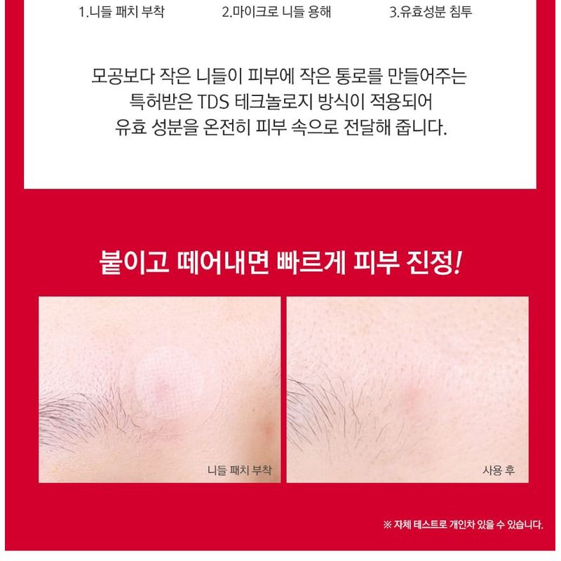 RiRe - Red Spot Micro Needle Patch