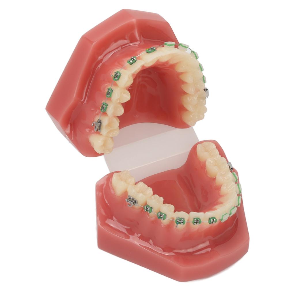 Modello Dimostrativo Ortodontico Dentale Modello di Denti con Fili Metallici e Bracket per Insegnamento