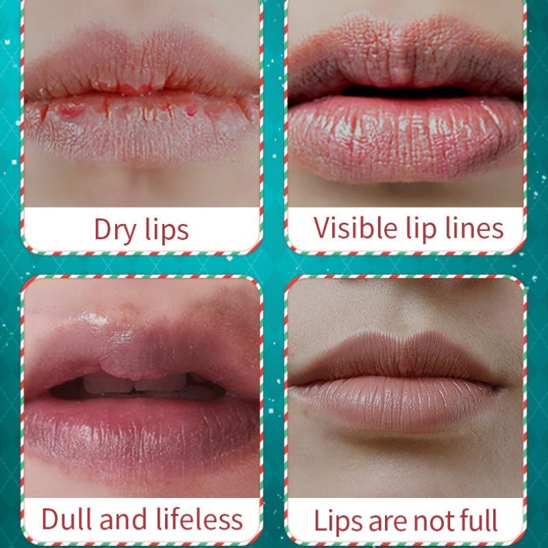 Christmas Lip Balm 5.8g Avocado Vaseline Moisturizing Nourishing Lip Balm Skin Care Products