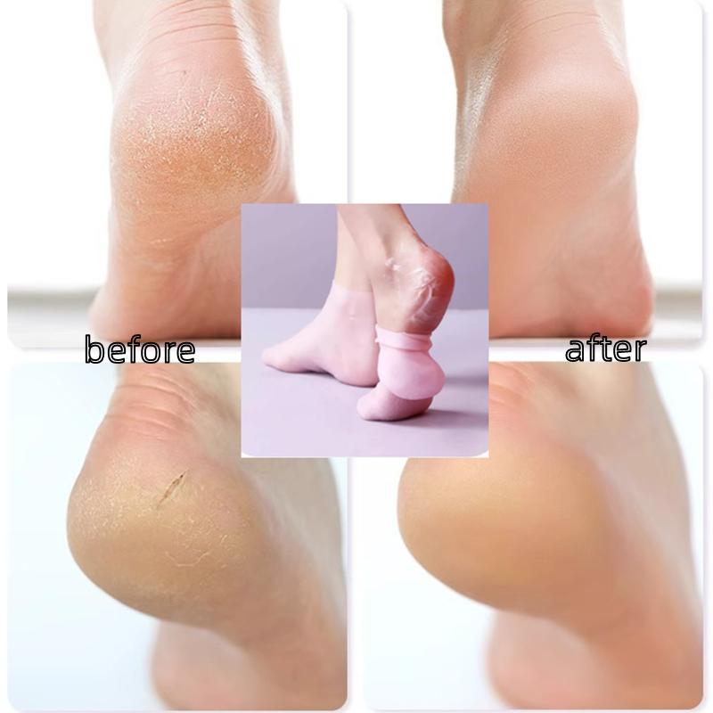 2Pairs Silicone Moisturizing Hand Gloves Foot Socks for Dry Cracked Feet Foot Care Socks Spa Pedicure Socks Massage Moisturizing Gel Gloves
