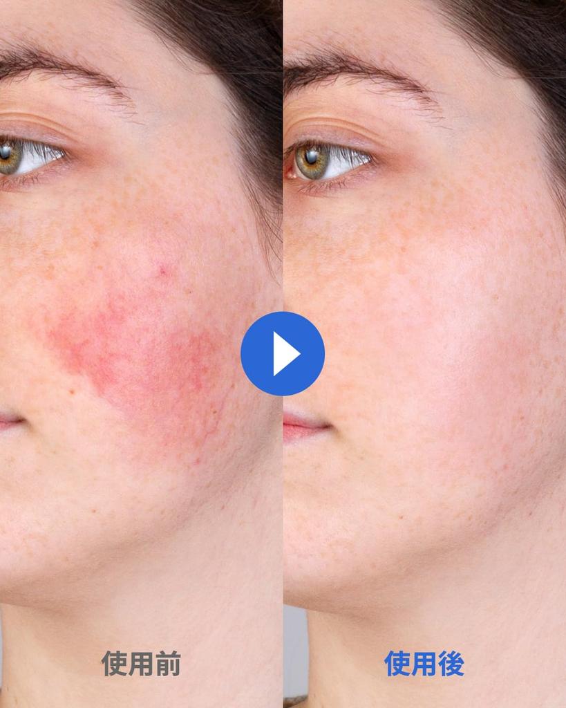 iBodle CCP CICA Ceramide and Panthenol Highly Moisturizing Barrier Natural Suitable for Dry and Sensitive Suitable for Babies and Newborn Full Body