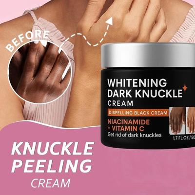 Dark Knuckle Whitening Cream 50g | with Niacinamide & Vitamin C | Elbow, Knee & Finger Brightening Remove Pigmentation