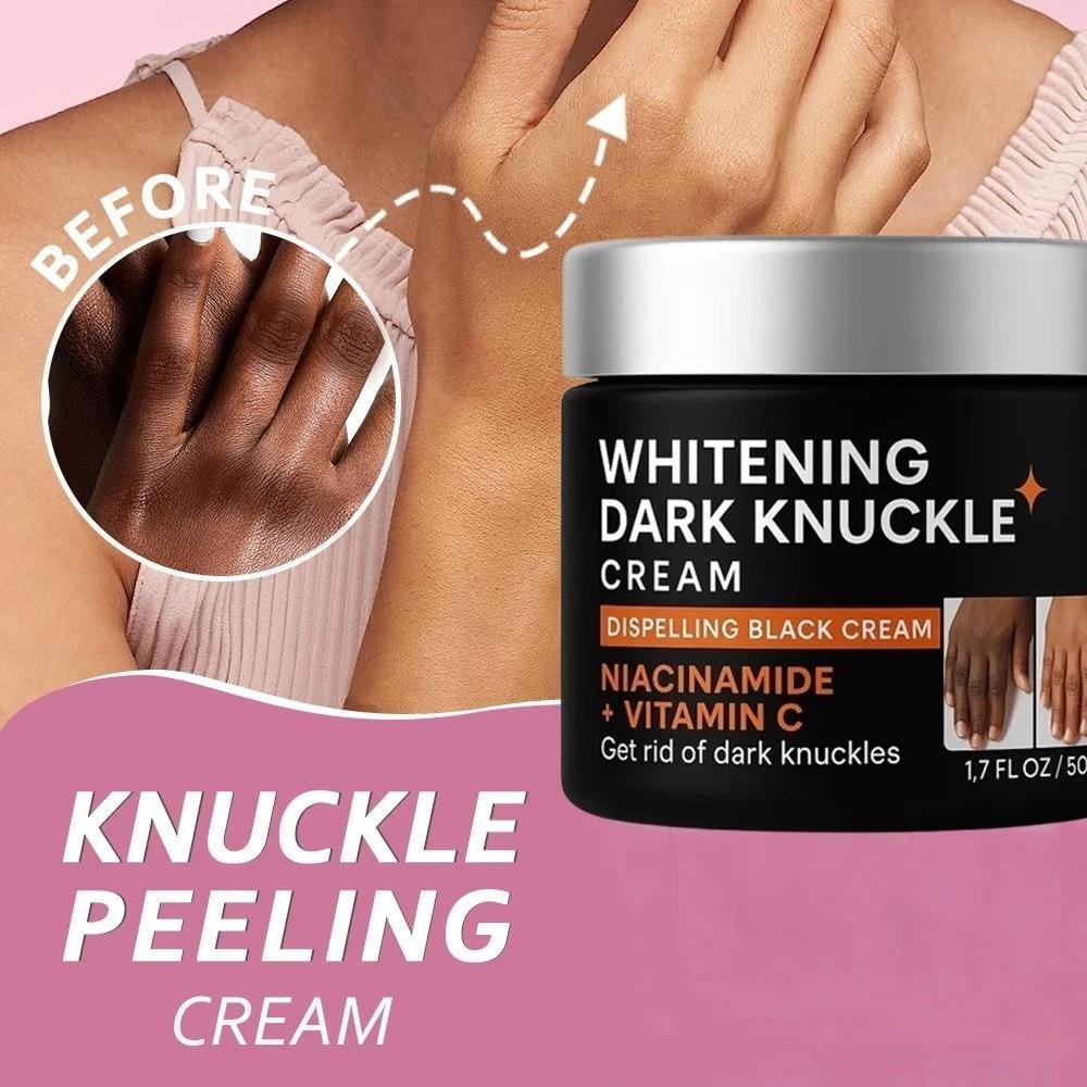 Dark Knuckle & Underarm Whitening Cream 50g | Body Moisturizer Lotion Dark Toe, Knuckles, Elbow, Inner Thigh, Neck Brightening