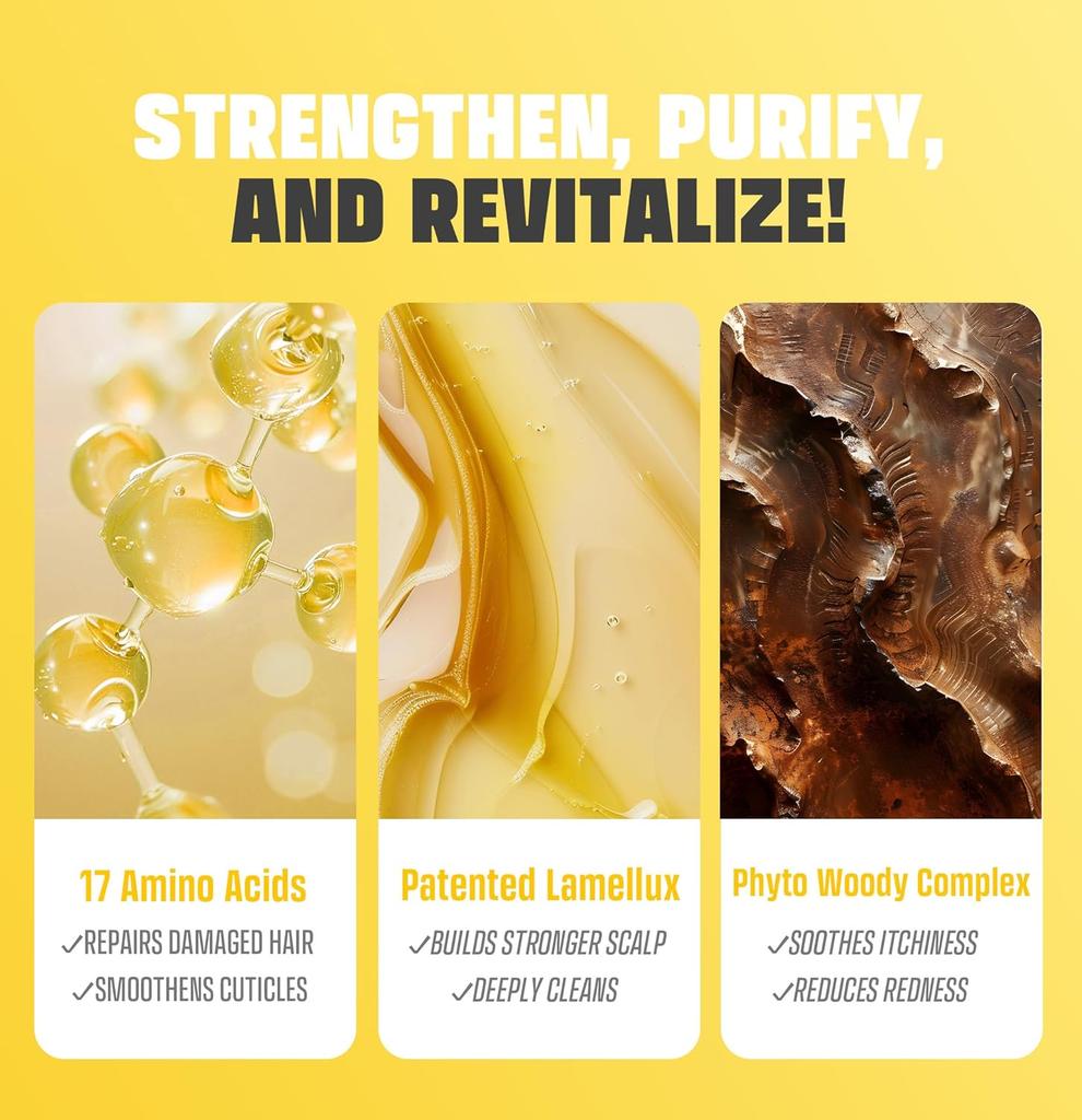 [MED:ALL] RCP-10 Anri-Hair Loss Shampoo 2.0 300ml