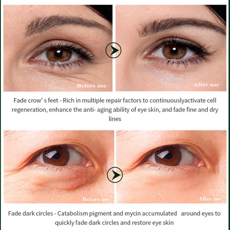 Snail Eye Cream Nourishing Dry Skin Fade Fine Lines Brighten Eye Collagen Cream Remove Dark Circles Eye Bags Skin Care Eye Bal