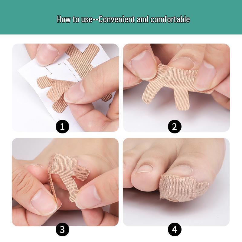 Plasture de corectare a unghiilor încarnate: Ameliorează Durerea și Promovează Creșterea Sănătoasă