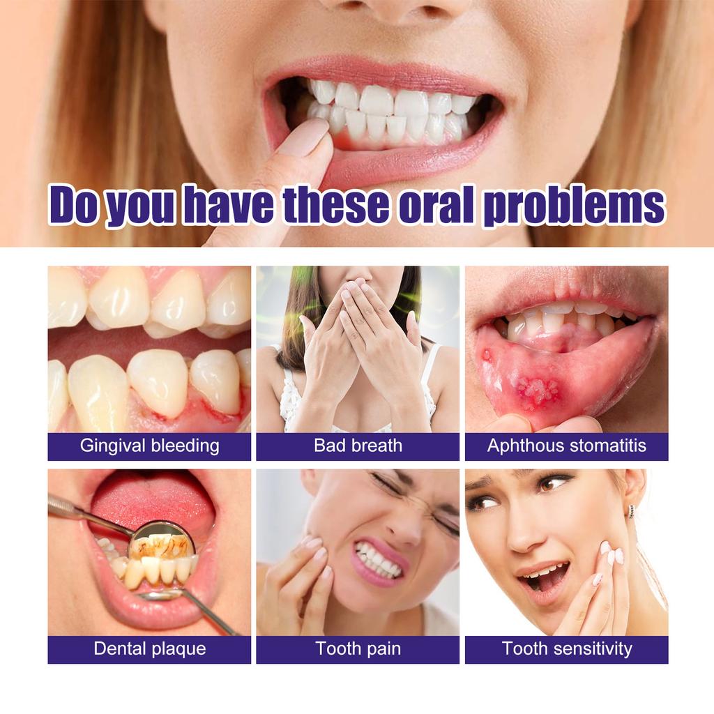 Tooth Whitening Foam Mousse Prevent Periodontitis Toothache Relief Dental Calculus Stain Removal Repair Gums Decay Oral Hygiene