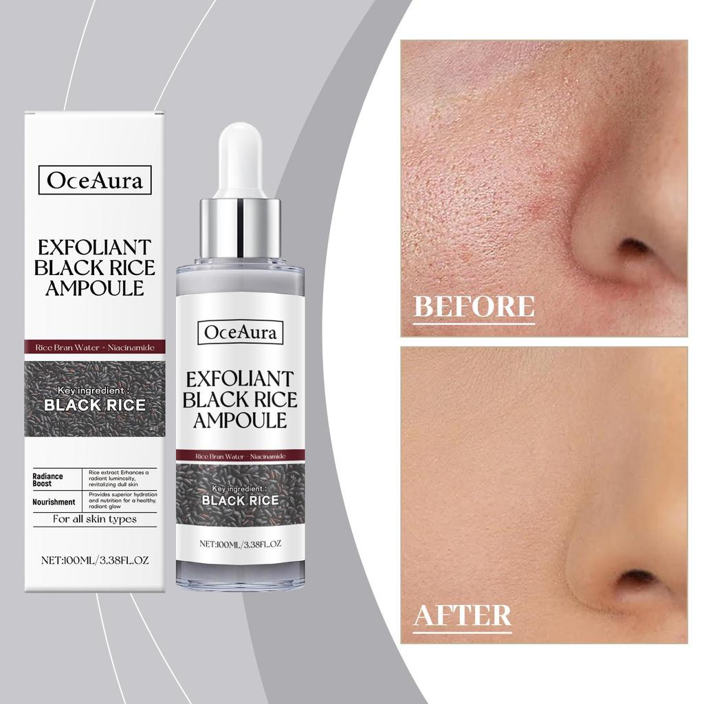 Black Rice Brightening Exfoliator Facial Cleansing Exfoliator Ampoule Softening Facial Serum