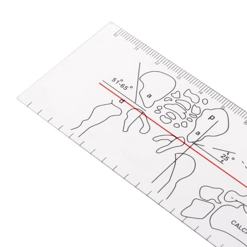 Goniometro Angolo 8 pollici Righello Medico Righello Articolazione Strumento Ortopedico Strumenti Plastica Squadretta