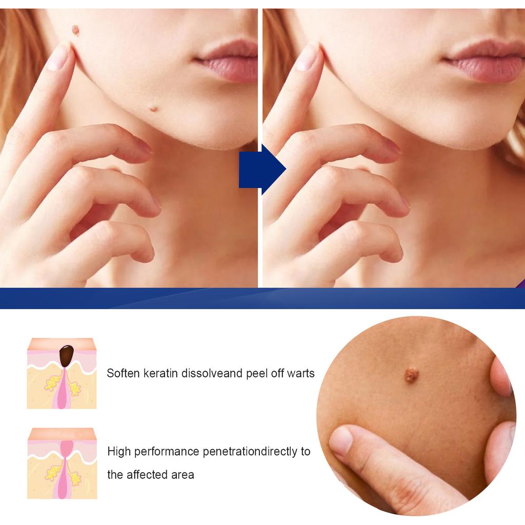 Hautglättende Pflegecreme Verbessert den Hautzustand Feuchtigkeitsspendende Pflege Narbenmildernde Narbenentfernungs-Pflegecreme