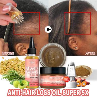 2024 Super 5x Hair Growth Oil Set Fenugreek Anti-Hair Loss Oil Rosemary Hair Regrowth Oil Chebe Batana Butter Hair Mask Amla Oil