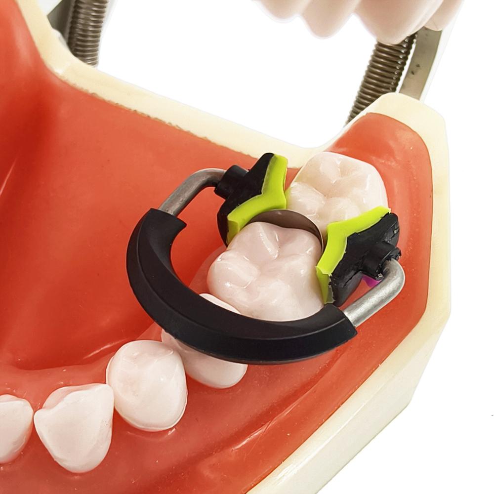 Dental Sectional Matrices Clip Matrix System NITI and Peek Material Ring Matrix Bands Dentistry Instrument Tool