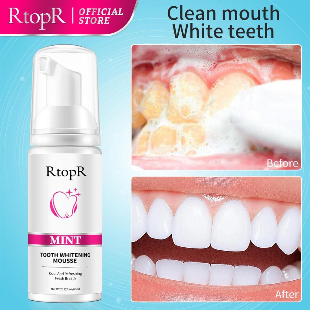 RtopR Mousse de blanchiment des dents, nettoyage des dents, taches, haleine fraîche, santé bucco-dentaire