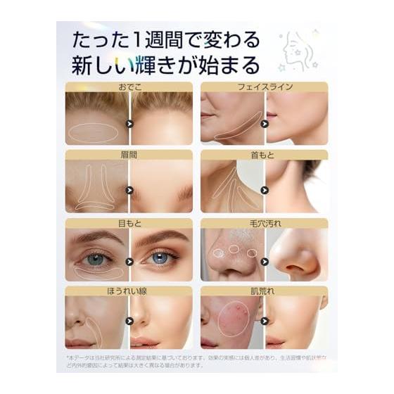 Facial Beauty Device, 18 Functions, RF EMS MC, Hot, Cold, High Frequency [2026 Industry's First, Radio Waves, Lift Care, Face Line Care, Pore