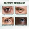 Eelhoe Eye Care Cream - Reduces Fine Lines, Improves Dullness, Moisturizes, Hydrates, Gentle And Firming, Multi-Effect Skin Softening