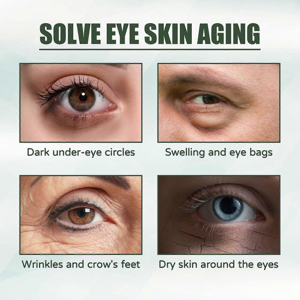 Eelhoe Eye Care Cream - Reduces Fine Lines, Improves Dullness, Moisturizes, Hydrates, Gentle And Firming, Multi-Effect Skin Softening