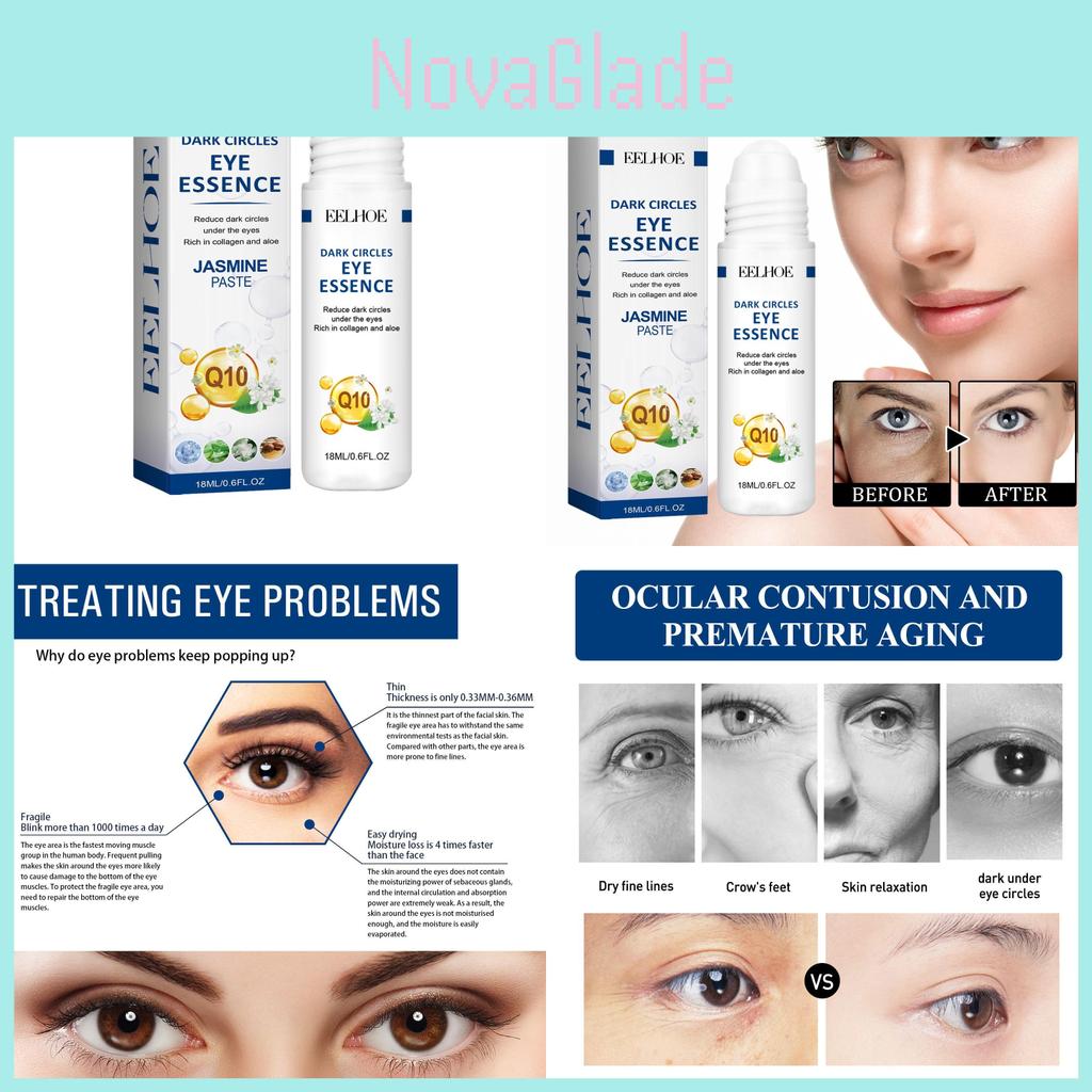 Eelhoe Anti-wrinkle Eye Serum 18ml Hydrating Formula For Dark Circle Reduction And Firming Skin