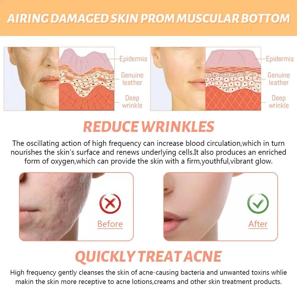 4 i 1 elektrodestav høyfrekvent elektroterapi glassrør Skjønnhetsenhet Akneflekkfjerner Ansiktsbehandling Antirynke Hudpleie Spa