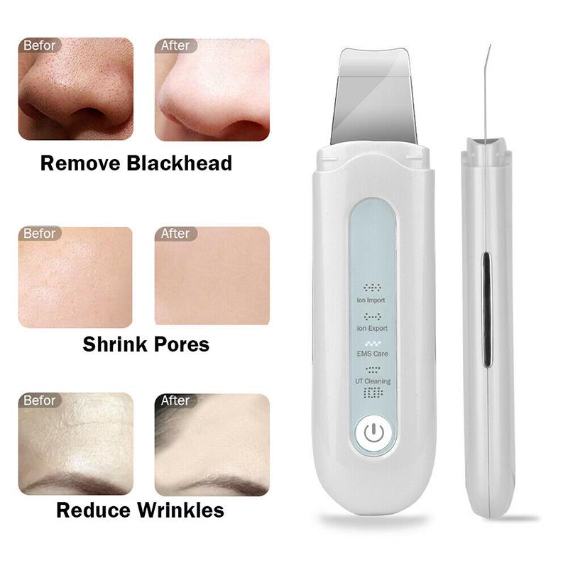 Buy PDTO Facial Ultrasonic Skin Scrubber Spatula Face Extractor Peeling