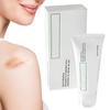 Scar Treatment, Gel That Helps Heal, Skin Damage