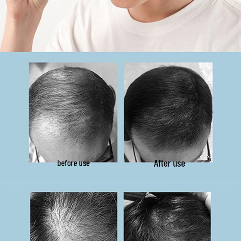 Portable Hair Care & Nourishing Device: Red Light Therapy Cap for Hair Growth